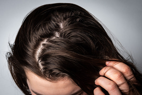 Cabello Graso